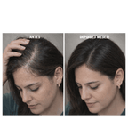 Minoxidil Turbinado - Spray